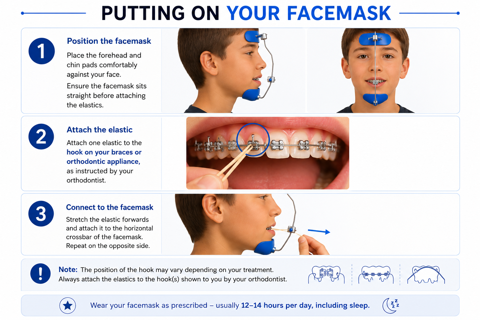 Facemask (Patient Instructions) - Smiles and Faces Orthodontics Blacktown